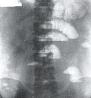 X-ray examination